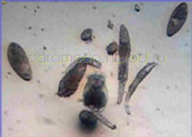  инфузории-туфельки, коловратки (Brachionus rubens и Philodina, бактерии 